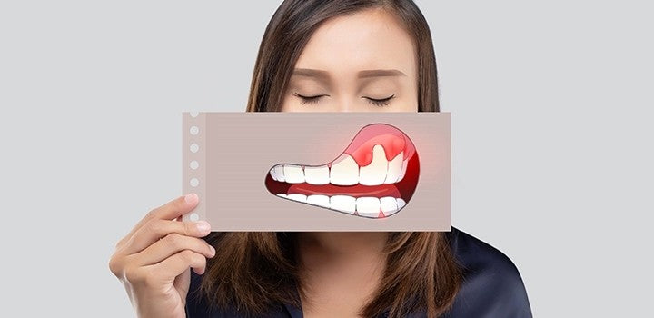 Are Your Gums Sensitive When You Brush?