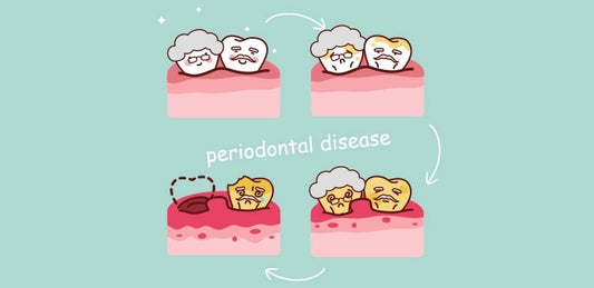 Periodontal Disease Stages: Available Treatments & Future Outlook